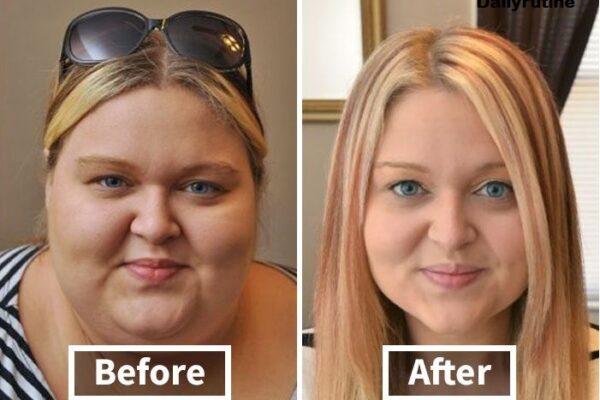 Face Weight Loss Before and After The Best Guide