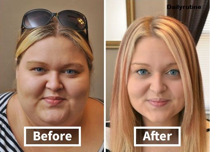 Face Weight Loss Before and After The Best Guide